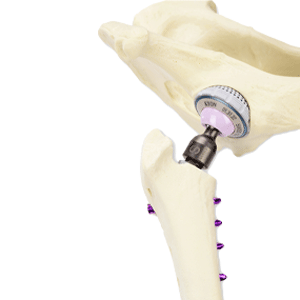 BioMedtrix