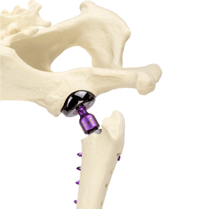 BioMedtrix