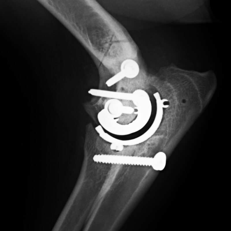 BioMedtrix