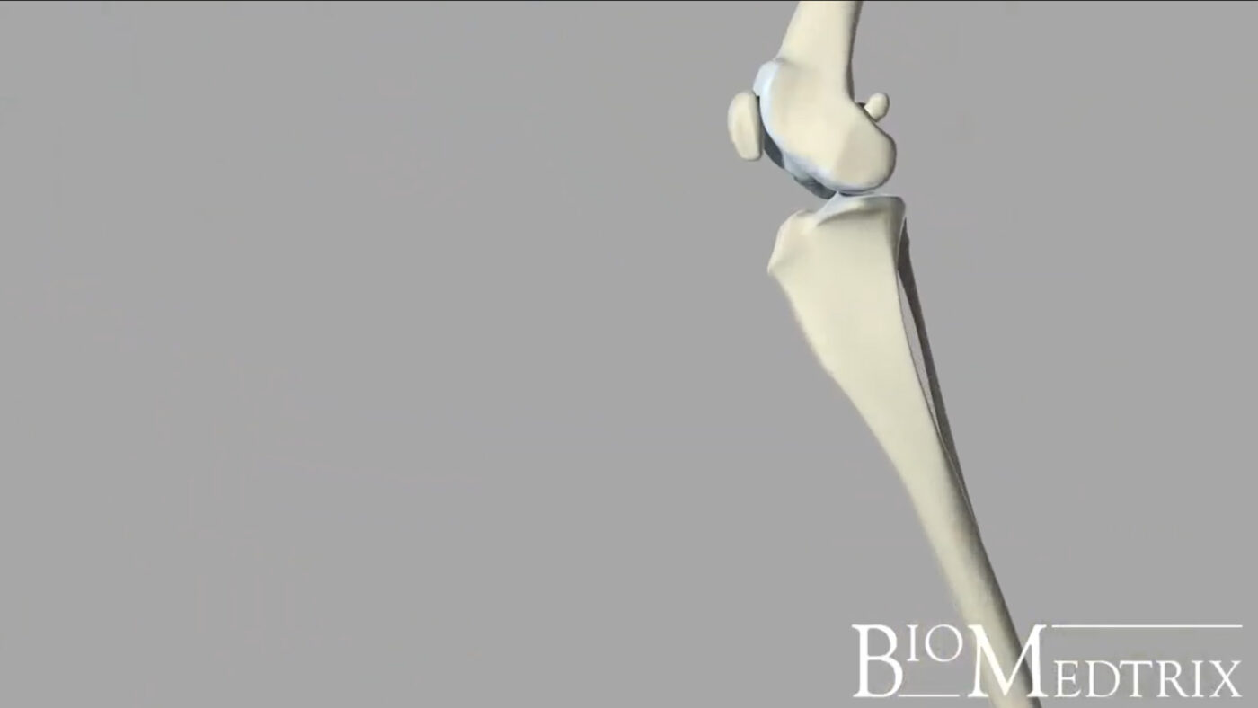 BioMedtrix